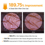 Peel Shot Kojic Acid Turmeric Duo